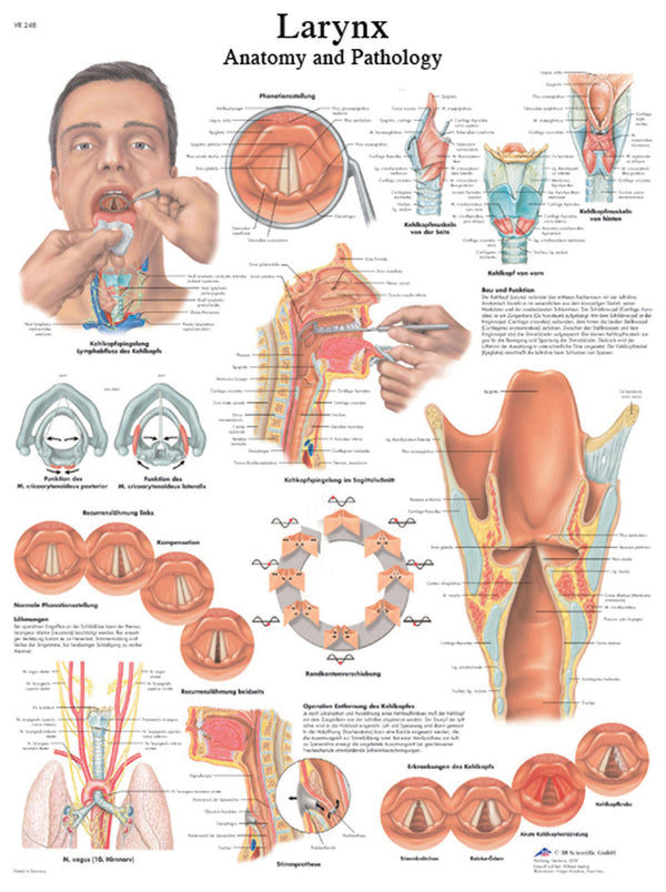 Anatomical Chart - larynx, paper