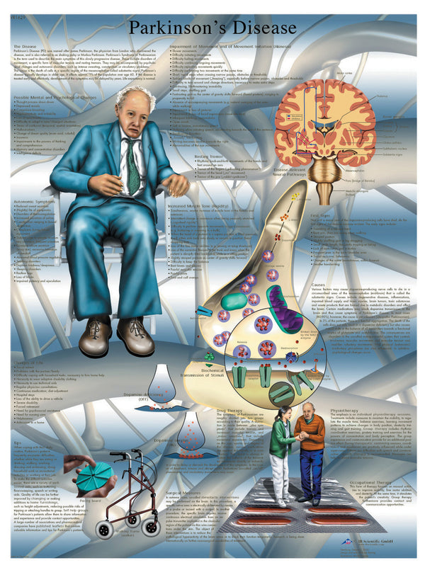 Anatomical Chart - Parkinson&#039;s disease, laminated