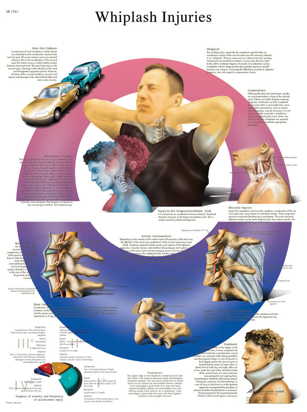 Anatomical Chart - whiplash, laminated